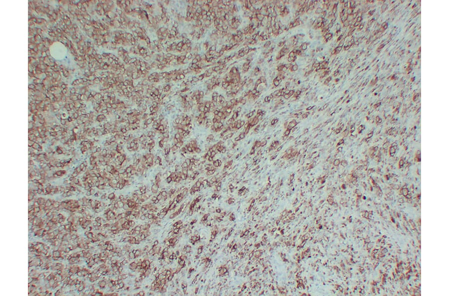 Immunohistochemistry - Anti-Tyrosinase Antibody (V0136) - Antibodies.com
