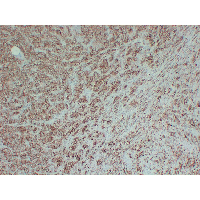 Immunohistochemistry - Anti-Tyrosinase Antibody (V0136) - Antibodies.com