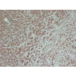 Immunohistochemistry - Anti-Tyrosinase Antibody (V0136) - Antibodies.com