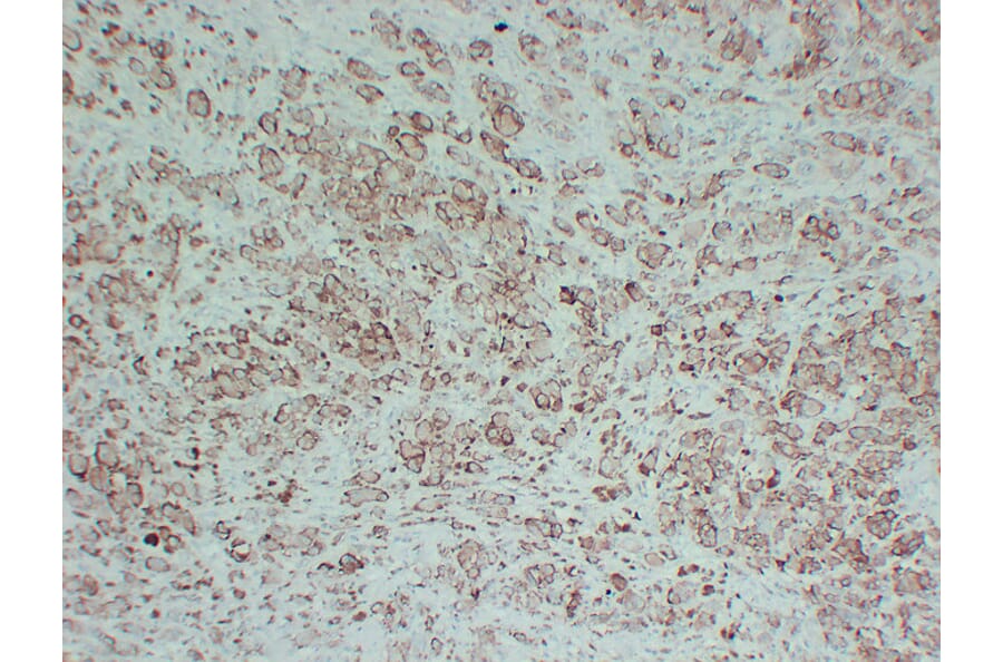 Immunohistochemistry - Anti-Tyrosinase Antibody (V0136) - Antibodies.com