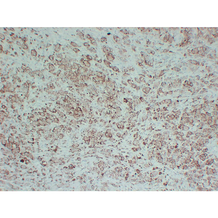 Immunohistochemistry - Anti-Tyrosinase Antibody (V0136) - Antibodies.com