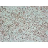 Immunohistochemistry - Anti-Tyrosinase Antibody (V0136) - Antibodies.com