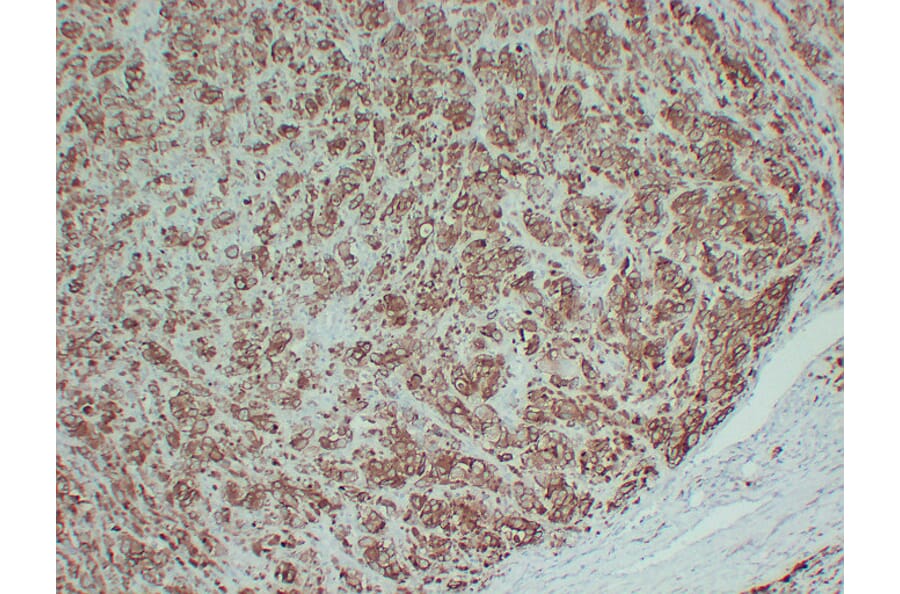 Immunohistochemistry - Anti-Tyrosinase Antibody (V0136) - Antibodies.com
