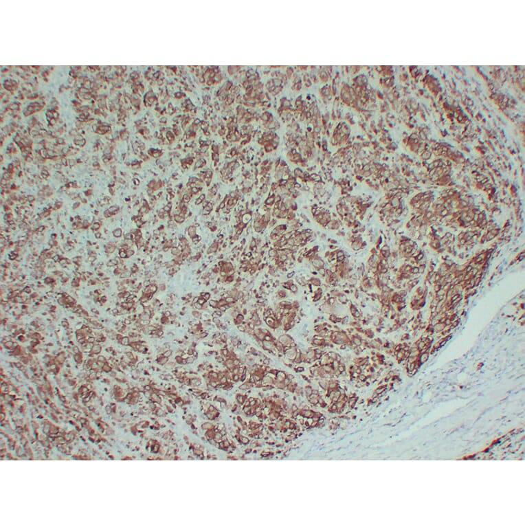 Immunohistochemistry - Anti-Tyrosinase Antibody (V0136) - Antibodies.com