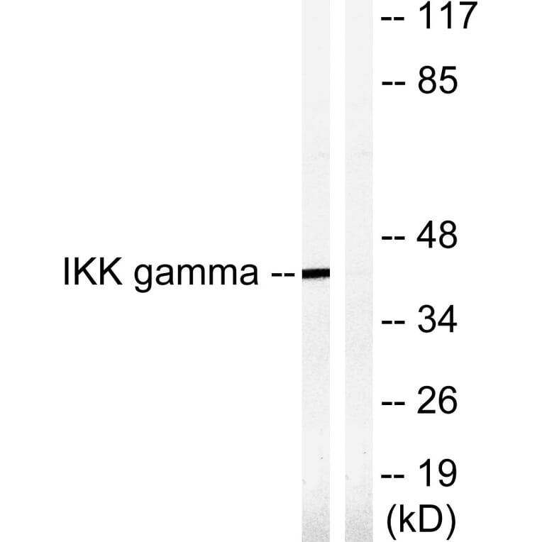 Western Blot - Anti-IKK-gamma Antibody (B1151) - Antibodies.com