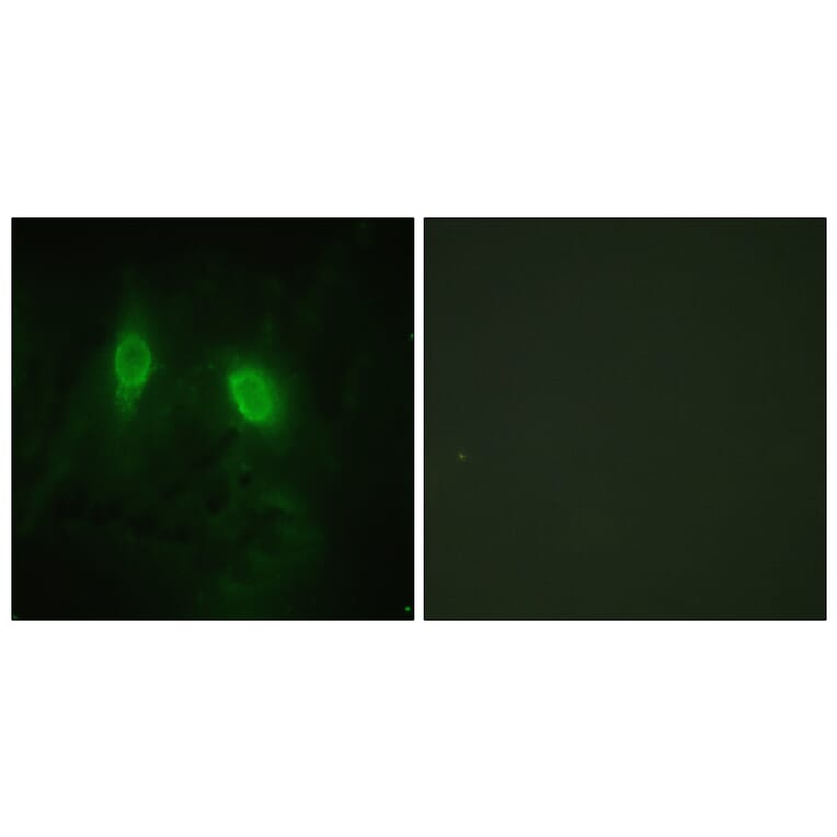 Immunofluorescence - Anti-IKK-gamma Antibody (B1151) - Antibodies.com