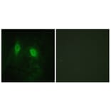 Immunofluorescence - Anti-IKK-gamma Antibody (B1151) - Antibodies.com