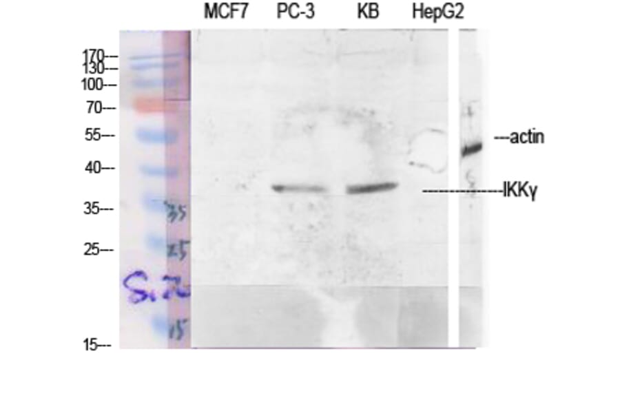 Western Blot - Anti-IKK-gamma Antibody (B1151) - Antibodies.com