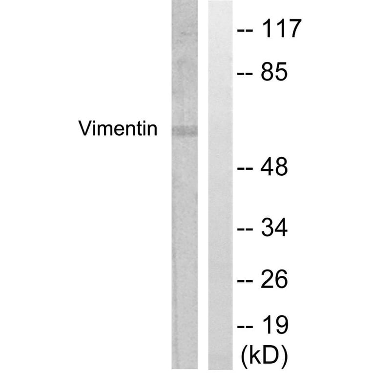 Western Blot - Anti-Vimentin Antibody (B1243) - Antibodies.com