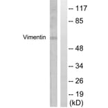 Western Blot - Anti-Vimentin Antibody (B1243) - Antibodies.com
