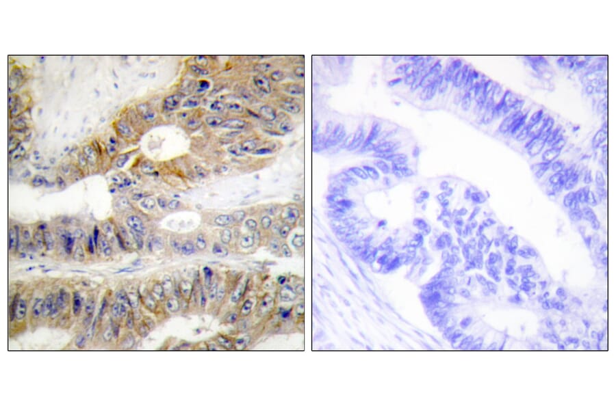 Immunohistochemistry - Anti-TNFRSF6B Antibody (C10229) - Antibodies.com