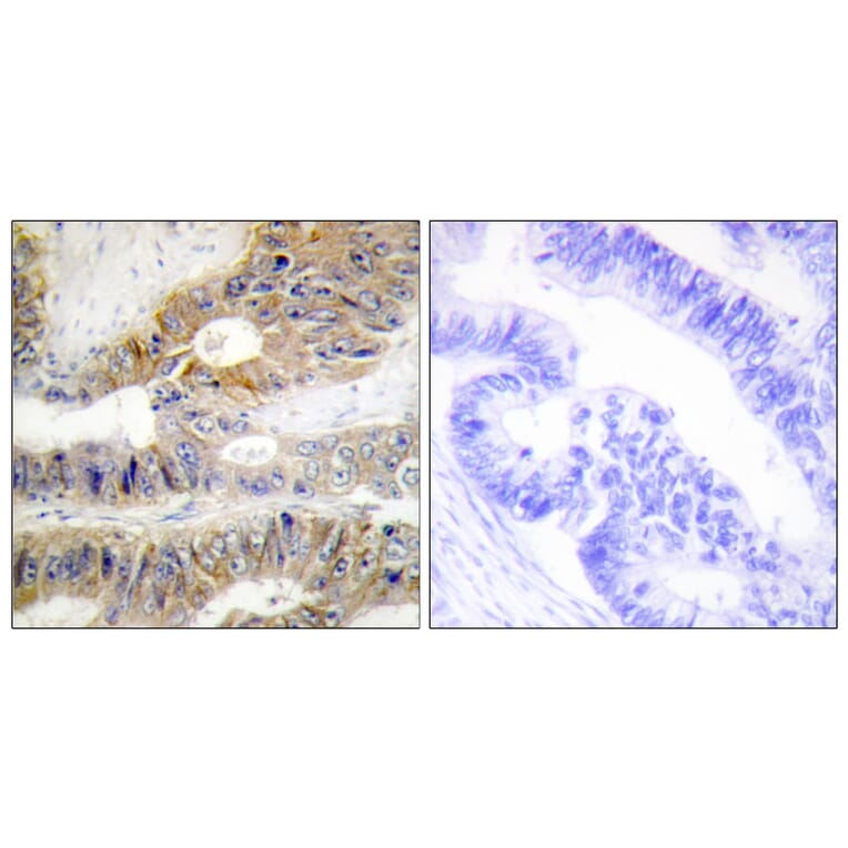 Immunohistochemistry - Anti-TNFRSF6B Antibody (C10229) - Antibodies.com