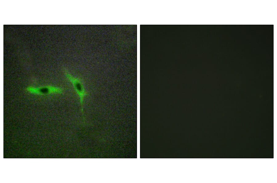 Immunofluorescence - Anti-TNFRSF6B Antibody (C10229) - Antibodies.com