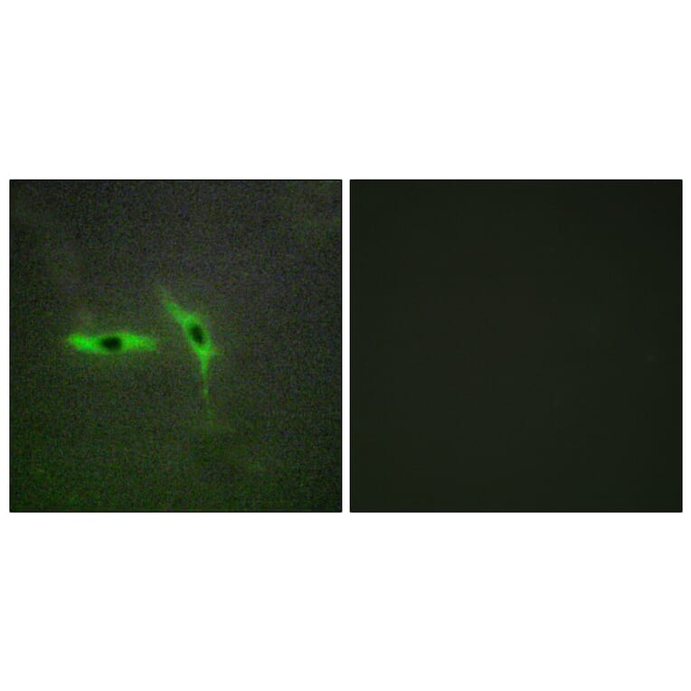Immunofluorescence - Anti-TNFRSF6B Antibody (C10229) - Antibodies.com