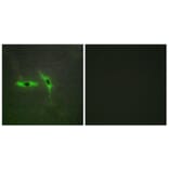 Immunofluorescence - Anti-TNFRSF6B Antibody (C10229) - Antibodies.com