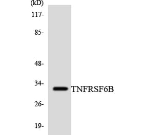 Western Blot - Anti-TNFRSF6B Antibody (R12-3639) - Antibodies.com