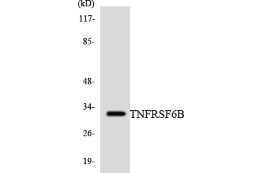 Western Blot - Anti-TNFRSF6B Antibody (R12-3639) - Antibodies.com