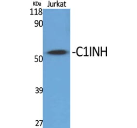 Western Blot - Anti-SERPING1 Antibody (C17738) - Antibodies.com