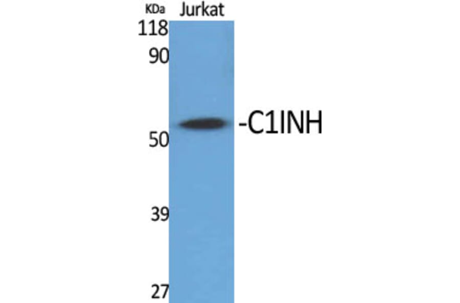 Western Blot - Anti-SERPING1 Antibody (C17738) - Antibodies.com