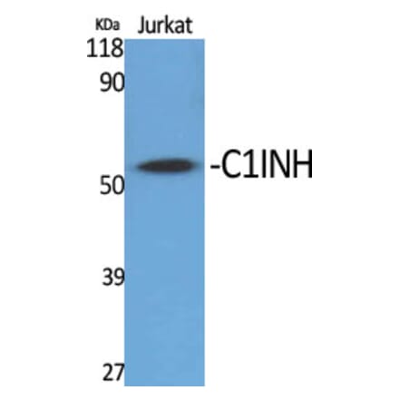 Western Blot - Anti-SERPING1 Antibody (C17738) - Antibodies.com