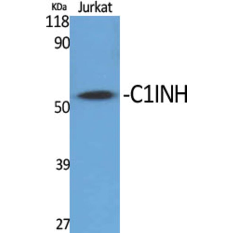 Western Blot - Anti-SERPING1 Antibody (C17738) - Antibodies.com
