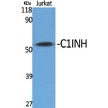 Western Blot - Anti-SERPING1 Antibody (C17738) - Antibodies.com