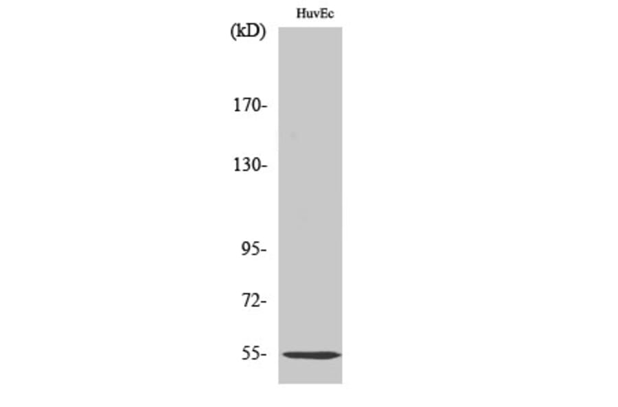 Western Blot - Anti-SERPING1 Antibody (C17738) - Antibodies.com