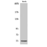 Western Blot - Anti-SERPING1 Antibody (C17738) - Antibodies.com