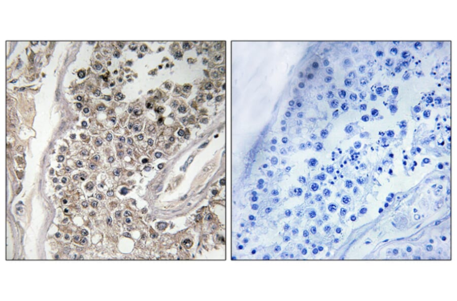 Immunohistochemistry - Anti-RAB3GAP1 Antibody (C18124) - Antibodies.com