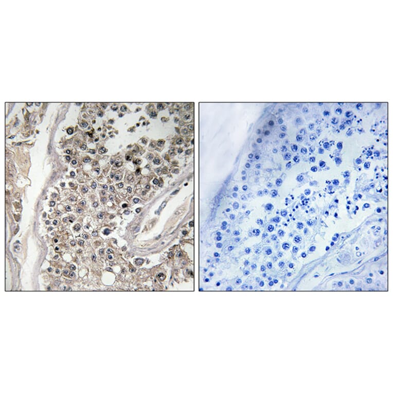 Immunohistochemistry - Anti-RAB3GAP1 Antibody (C18124) - Antibodies.com