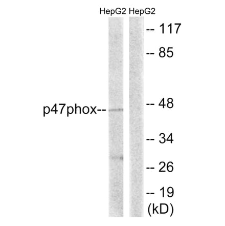 Western Blot - Anti-p47 phox Antibody (B8391) - Antibodies.com