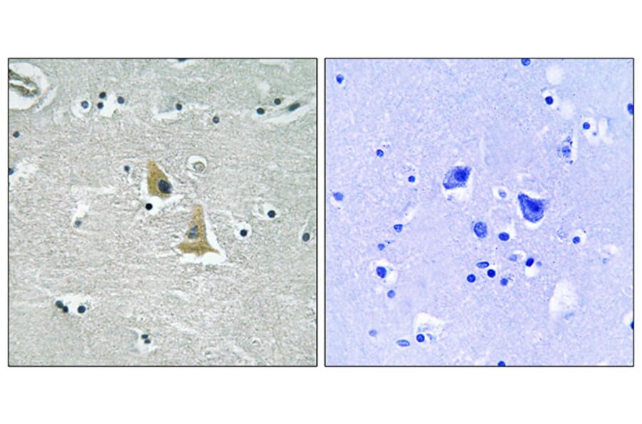 Immunohistochemistry - Anti-p47 phox Antibody (B8391) - Antibodies.com