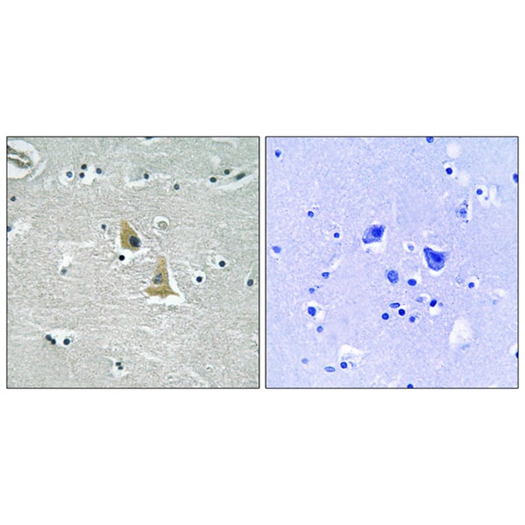 Immunohistochemistry - Anti-p47 phox Antibody (B8391) - Antibodies.com