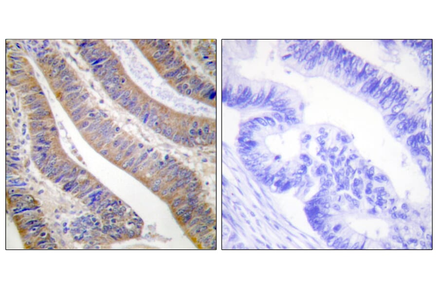 Immunohistochemistry - Anti-p47 phox Antibody (B1172) - Antibodies.com