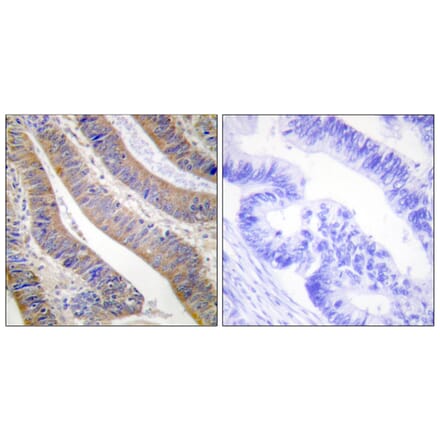 Immunohistochemistry - Anti-p47 phox Antibody (B1172) - Antibodies.com