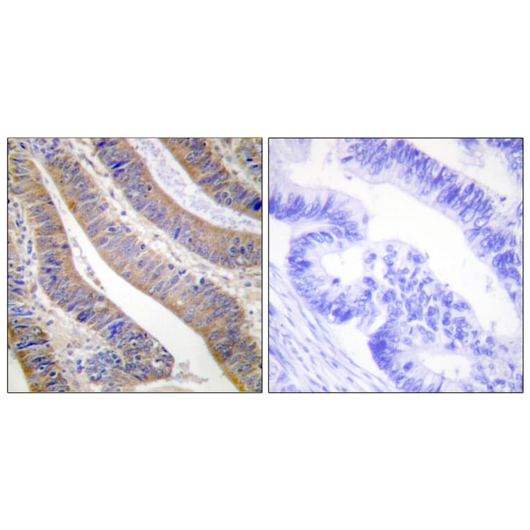 Immunohistochemistry - Anti-p47 phox Antibody (B1172) - Antibodies.com