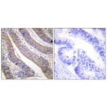 Immunohistochemistry - Anti-p47 phox Antibody (B1172) - Antibodies.com