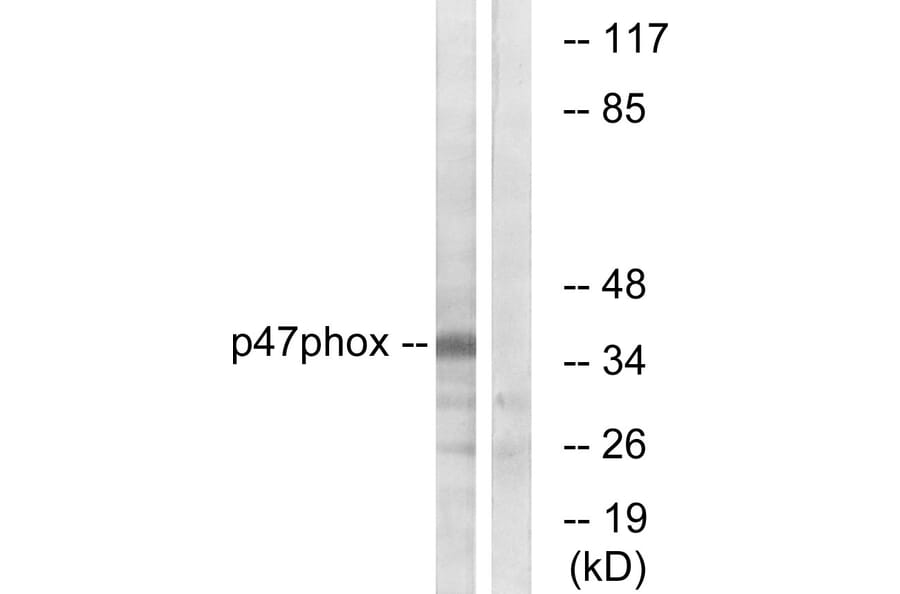 Western Blot - Anti-p47 phox Antibody (B1172) - Antibodies.com