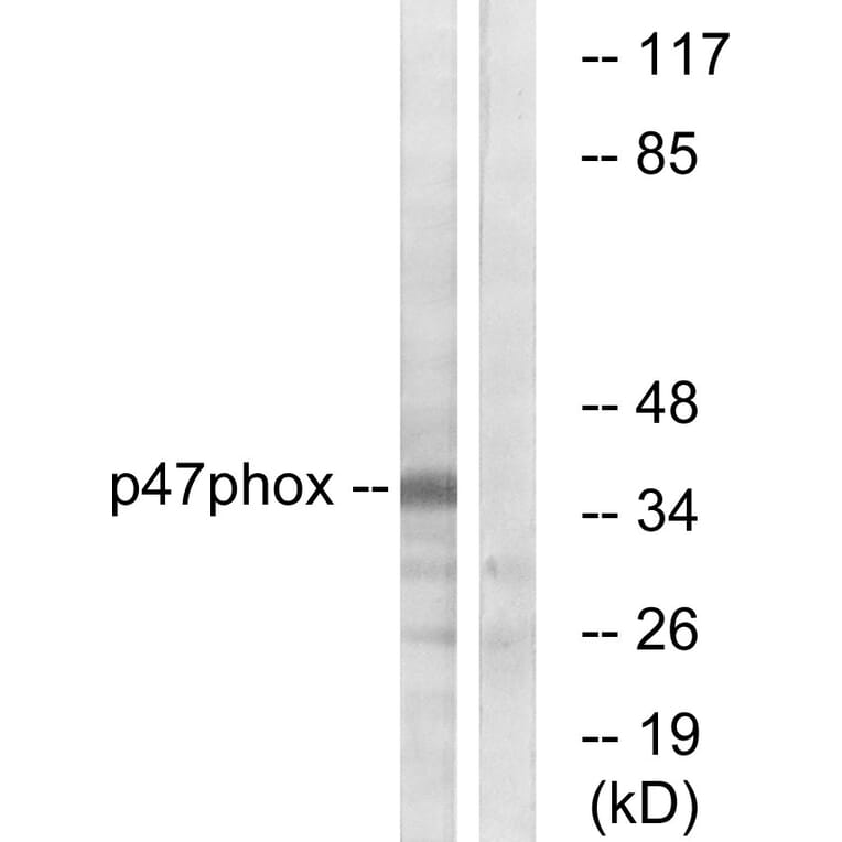 Western Blot - Anti-p47 phox Antibody (B1172) - Antibodies.com