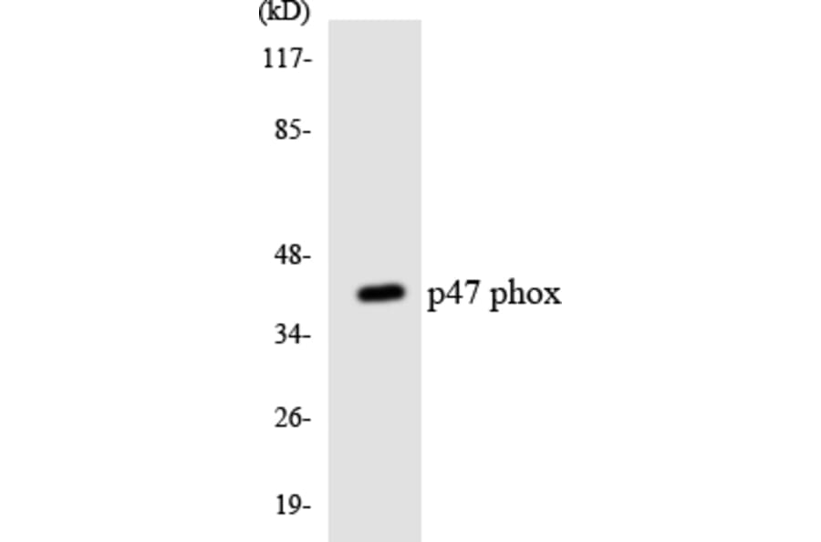 Western Blot - Anti-p47 phox Antibody (R12-3285) - Antibodies.com