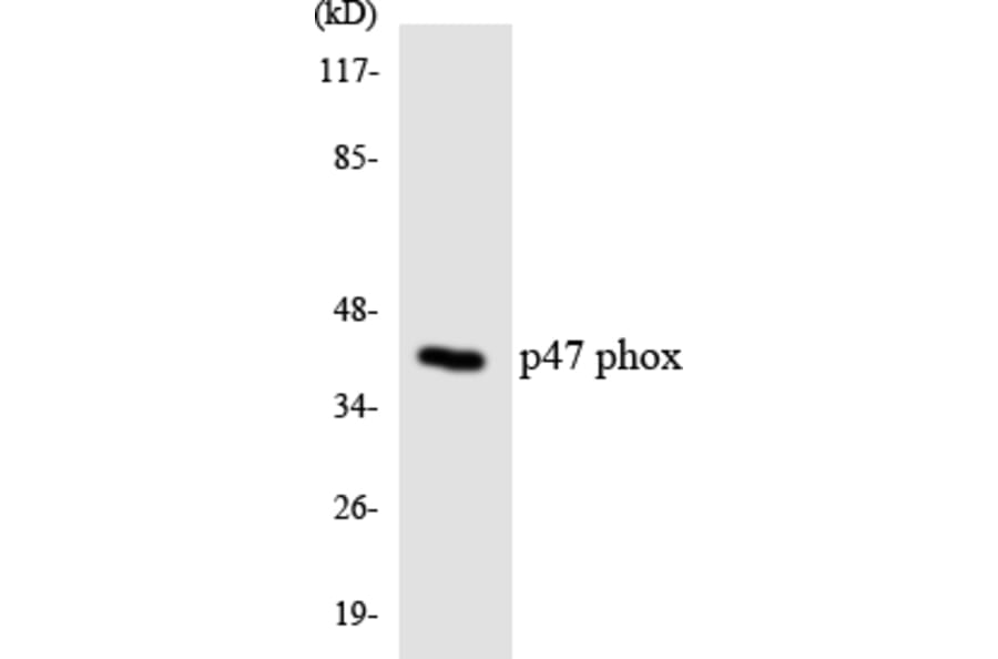 Western Blot - Anti-p47 phox Antibody (R12-3286) - Antibodies.com