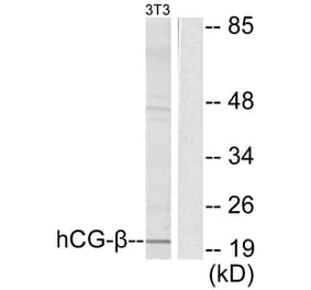 Western Blot - Anti-hCG beta Antibody (C0220) - Antibodies.com