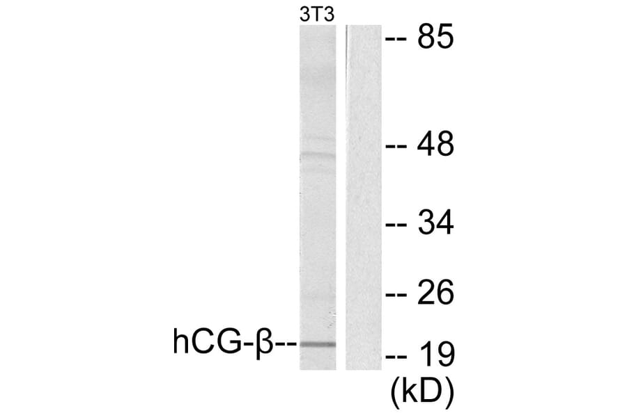 Western Blot - Anti-hCG beta Antibody (C0220) - Antibodies.com