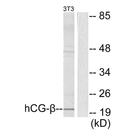 Western Blot - Anti-hCG beta Antibody (C0220) - Antibodies.com