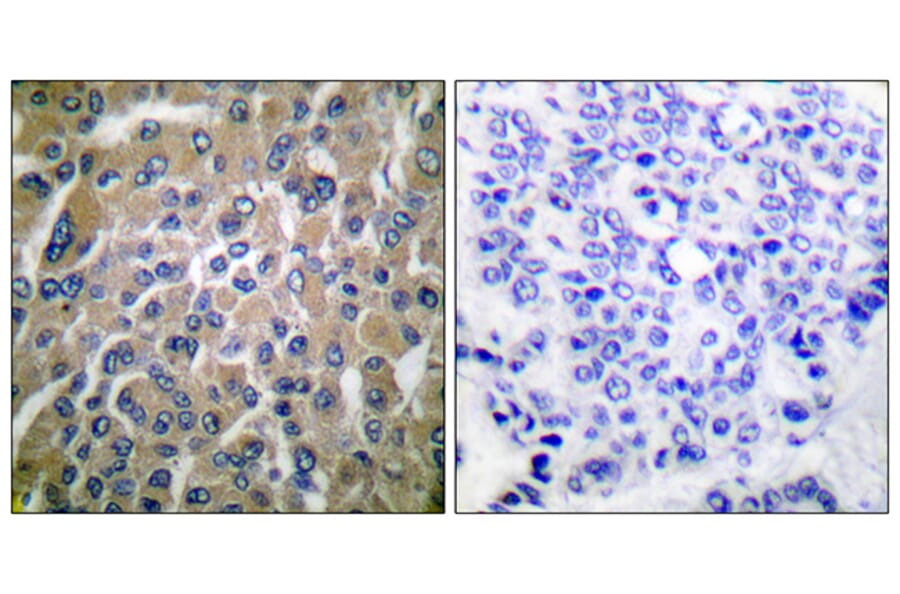 Immunohistochemistry - Anti-hCG beta Antibody (C0220) - Antibodies.com