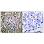 Immunohistochemistry - Anti-hCG beta Antibody (C0220) - Antibodies.com