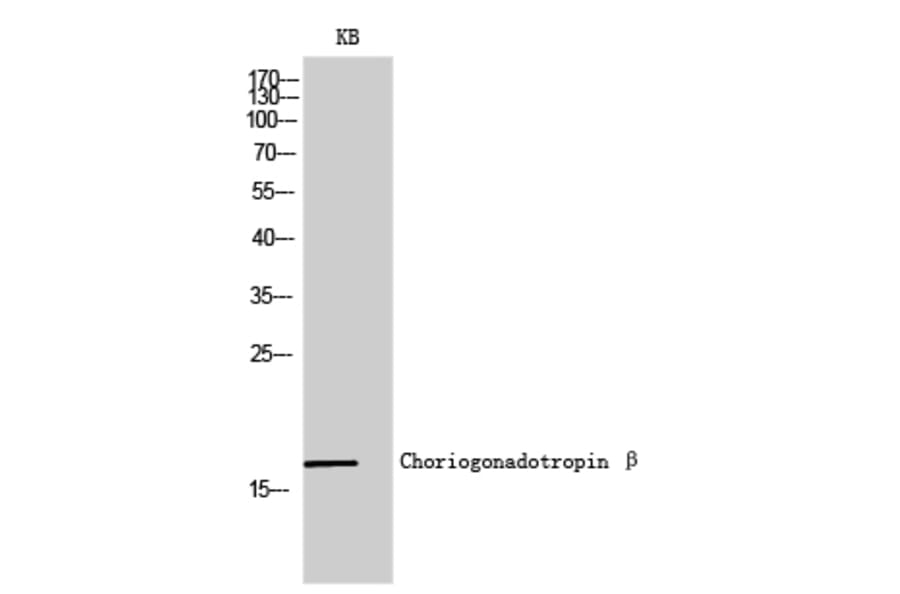 Western Blot - Anti-hCG beta Antibody (C0220) - Antibodies.com