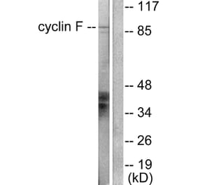 Western Blot - Anti-Cyclin F Antibody (C0168) - Antibodies.com