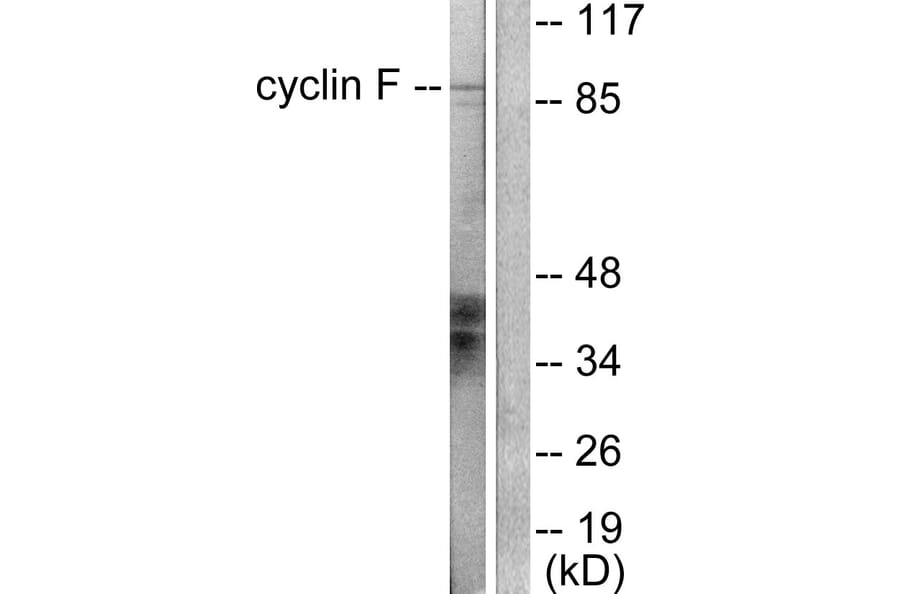 Western Blot - Anti-Cyclin F Antibody (C0168) - Antibodies.com