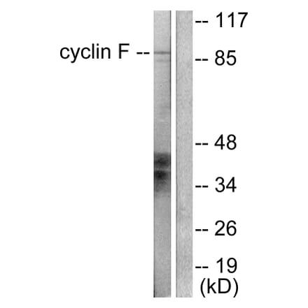 Western Blot - Anti-Cyclin F Antibody (C0168) - Antibodies.com